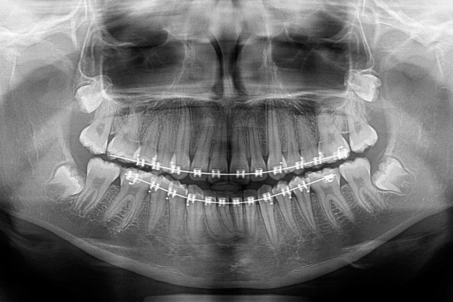 radiografia pan
